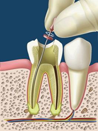 Endodonzia